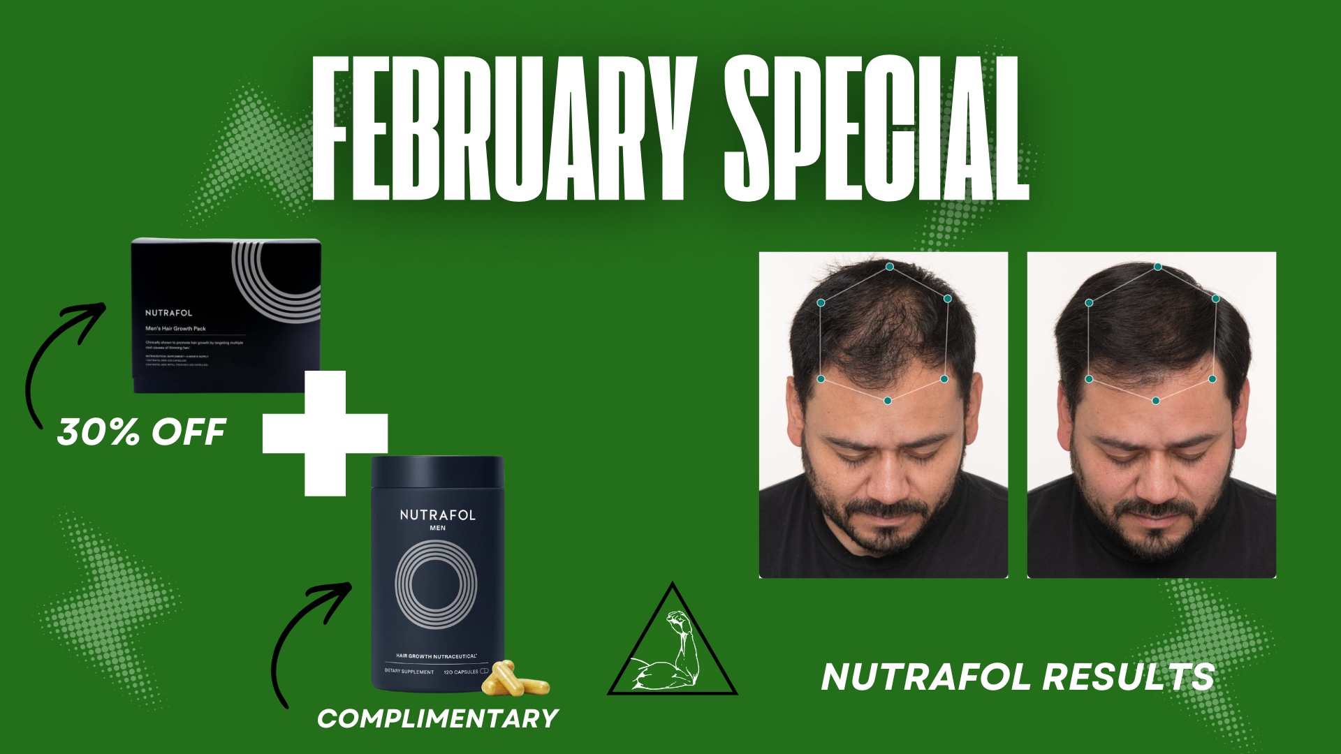 30% off Nutrafol 3-month supply in Rogers, AR